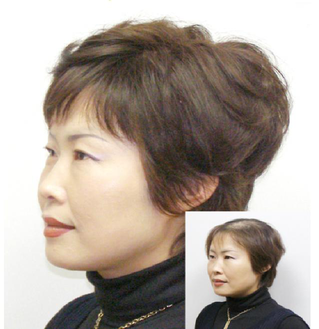 센스모 대구점 대구가발착용사진